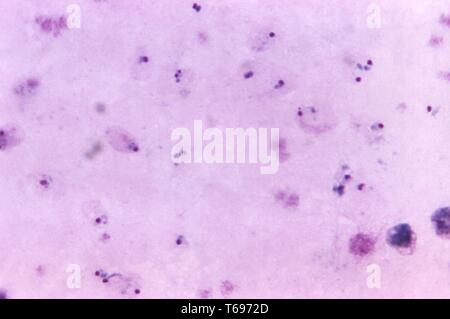 Film épais de Giemsa photomicrographie d'un Plasmodium vivax sonne et un vieux, 1971. trophozoïte Image courtoisie Centres for Disease Control and Prevention (CDC) / Dr Mae Melvin. () Banque D'Images