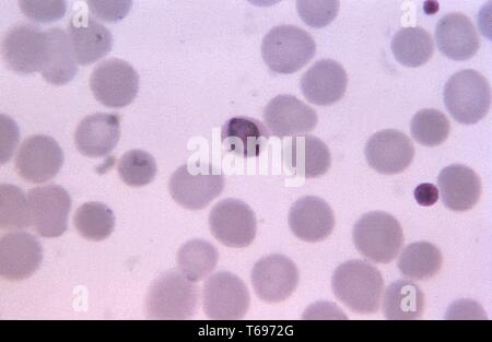 Giemsa mince film photomicrographie d'un Plasmodium malariae immatures, schizonte 1971. Image courtoisie Centres for Disease Control and Prevention (CDC) / Dr Mae Melvin. () Banque D'Images