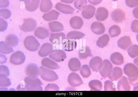 Un film mince photomicrographie de Plasmodium malariae macrogametocyte, 1966. Image courtoisie Centres for Disease Control and Prevention (CDC) / Dr Mae Melvin. () Banque D'Images