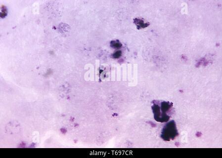 Giemsa mince film photomicrographie d'un Plasmodium malariae mature, schizontes 1971. Image courtoisie Centres for Disease Control and Prevention (CDC) / Dr Mae Melvin. () Banque D'Images