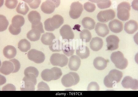 Giemsa mince film photomicrographie d'un Plasmodium malariae ring, 1971. Image courtoisie Centres for Disease Control and Prevention (CDC) / Dr Mae Melvin. () Banque D'Images