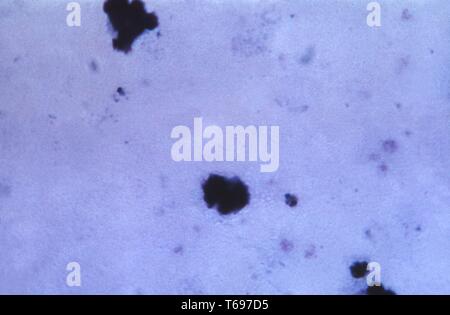 Film épais photomicrographie de les deux jeunes, Plasmodium malariae croissante, les trophozoïtes 1965. Image courtoisie Centres for Disease Control and Prevention (CDC) / Dr Mae Melvin. () Banque D'Images