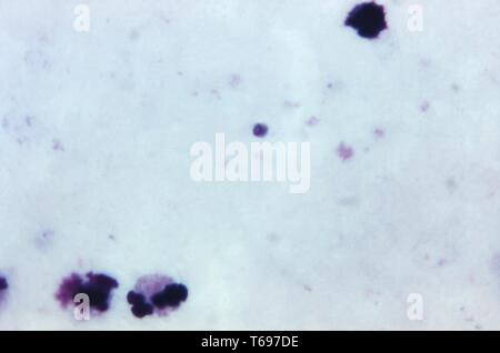 Film épais de Giemsa photomicrographie de plus en plus un trophozoïte, Plasmodium malariae 1973. Image courtoisie Centres for Disease Control and Prevention (CDC) / Dr Mae Melvin. () Banque D'Images