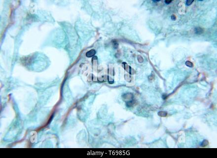 Methenamine tache argentée photomicrographie des changements histopathologiques dans un testicule de souris indiquant pénicilliose due à Penicillium marneffei, 1972. Image courtoisie Centres for Disease Control and Prevention (CDC) / Dr. Libero Ajello. () Banque D'Images