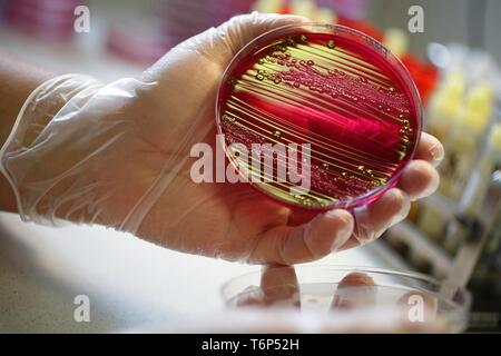 Boîte de Pétri avec milieu de culture avec des cultures bactériennes, laboratoire médical, Karlovy Vary, République Tchèque Banque D'Images