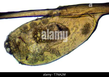 Poux de tête - Pediculus capitis, microscope photo, mèche de cheveux avec l'œuf pou Banque D'Images