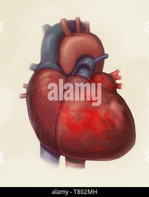 L'insuffisance cardiaque, illustration Banque D'Images