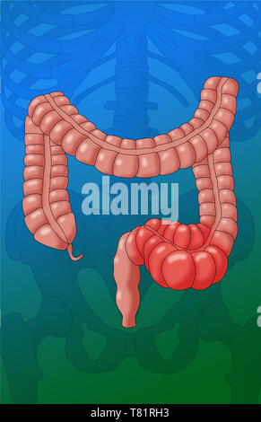 Côlon constipé, illustration Banque D'Images