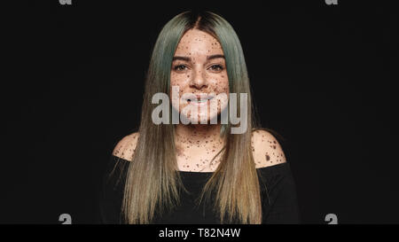 Close up of young woman looking at camera isolé sur fond noir. Femme souriante avec des taches de rousseur ou taupe sur son corps. Banque D'Images