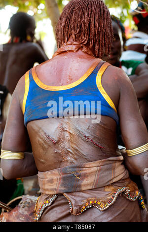 Les blessures ouvertes d'un coup de fouet cervical lors de bull jumping cérémonie, tribu Hamar, Ethiopie Banque D'Images