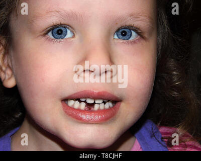 Jeune fille aux yeux bleus, lui montrant les dents manquantes Banque D'Images