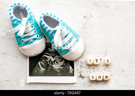 Chaussons pour bébé bleu avec une photo de l'échographie pendant 20 semaines sur un fond clair. C'est fils d'inscription Banque D'Images