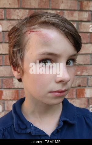 Portrait d'un enfant avec un gros bleu et coupe sur le front à la peur Banque D'Images