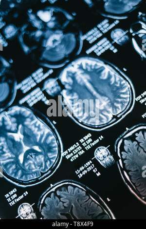 L'image par résonance magnétique de la tête. X-ray, IRM, du cerveau, de la médecine, de la science Banque D'Images