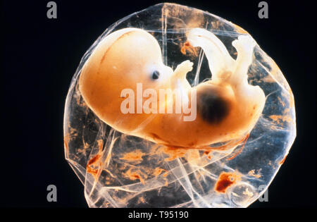 Foetus humain dans la membrane à 6 semaines. Et les membres de l'œil visible. L'accent est mis sur la différenciation des organes à ce stade. Les étapes subséquentes du développement perspective se déplace à growthg du fœtus. Banque D'Images