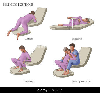 Illustration de quatre différentes positions d'accouchement : 4 pattes, couchée, accroupie, et s'accroupir avec un partenaire. Banque D'Images