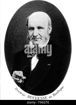 Guillaume-Benjamin Duchenne de Boulogne-Amand (17 septembre 1806 - 15 septembre 1875) est un neurologue français qui a permis à la science de l'électrophysiologie. Influencé par les croyances de physionomie, la dystrophie voulait déterminer comment les muscles dans le visage humain produisent des expressions du visage qu'il croyait être directement liée à l'âme de l'homme. Banque D'Images