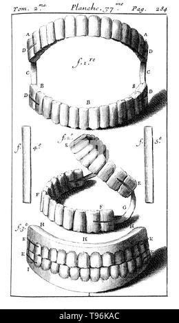 Ensemble complet de dentiers avec ressorts. Tome 2. Planche 37. P. 284. Pierre Fauchard (1678 - 22 mars 1761) était un médecin français, considéré comme étant le père de la dentisterie moderne. Il est largement connu pour être la première description scientifique de la médecine dentaire, Le Chirurgien dentiste (chirurgien dentiste), le publié en 1728. Banque D'Images