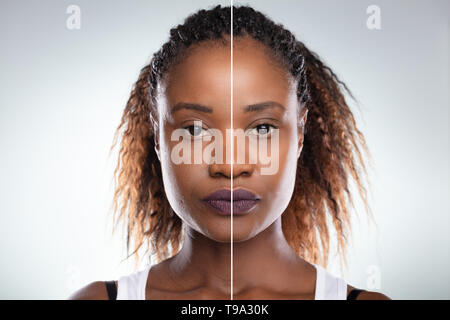 Close-up of a young woman's Face avant et après intervention cosmétique Banque D'Images