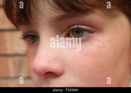 Gros plan du jeune enfant fâché avec les yeux verts et un nez rouge avec une larme dans l'oeil Banque D'Images