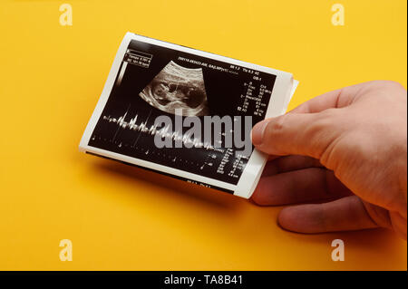 Échographie avec futur bébé paramètres dans la main sur fond jaune Banque D'Images