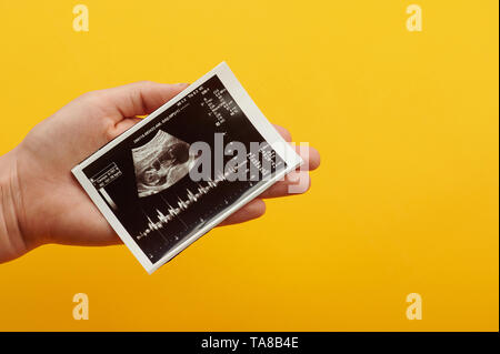 Tenir la main à l'échographie cardiaque de bébé nouveau-né Banque D'Images