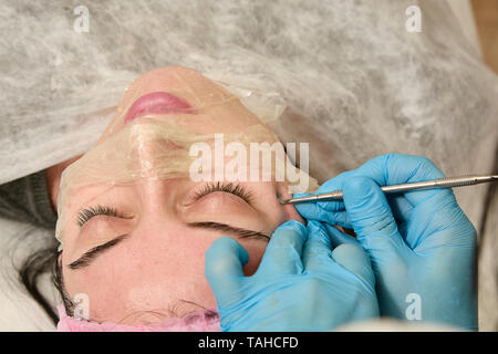 Jeune femme au salon de la commande manuelle nettoyage du visage. La suppression manuelle de bourgeon, l'acné, la tête noire, furoncle purulent sur le visage. Médecine et beauté eq Banque D'Images