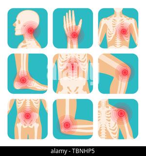 Jeu de cercle rouge localisation de la douleur, corps humain, squelette, des articulations et des os Illustration de Vecteur