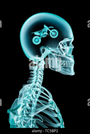 X-ray fan de motocross / 3D illustration du squelette humain x-ray montrant dirt bike inside head Banque D'Images