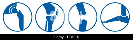 Articulation du Genou hanche fracture du tibia fémur pied prothèse vecteur orthopédique icônes logos Illustration de Vecteur