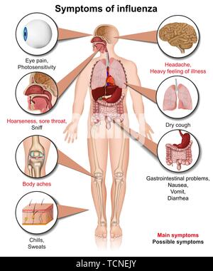 Les symptômes de l'influenza médicale 3d vector illustration infographie isolé sur fond blanc Illustration de Vecteur