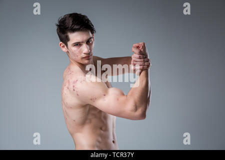 Studio portrait jeune homme de race blanche sur fond gris posing. thème de la puberté, les peaux à problèmes, acné de l'adolescence. Remise en forme de l'athlète de race blanche. Sports allergie nu Banque D'Images