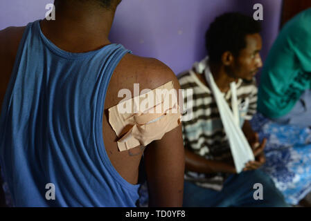 Khartoum, Soudan. 10 Juin, 2019. Amar Mohammed al-Hassan (l) et Abdu al-Rahim montrer leurs blessures. 18-year-old Amar Mohammed al-Hassan et ses amis Abdu al-Rahim et Ali Idris étaient présents la semaine dernière lorsque les forces de sécurité ont brutalement brisé le blocus des sit-in dans le centre de la capitale soudanaise. Des manifestants ont été abattus, battus et chassés, tentes brûlées et les corps jetés dans le Nil. Selon une association médicale, plus de 100 personnes sont mortes. (Dpa 'Revolution au Soudan : 'il vient de commencer') Credit : Gioia Forster/dpa/Alamy Live News Banque D'Images