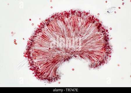 La moisissure Aspergillus (spec.), les conidies, section transversale, x 80, Allemagne Banque D'Images