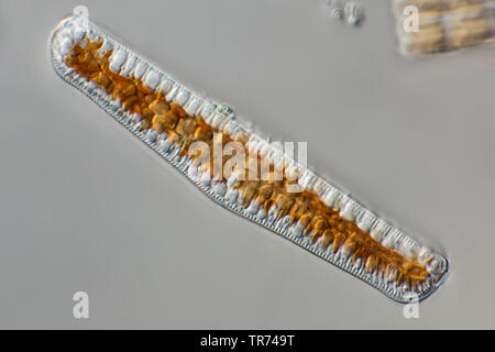 Diatomées (Diatomeae), diatomées vivant d'ouest de l'Islande, en contraste d'interférence différentielle, x 120, l'Islande Banque D'Images