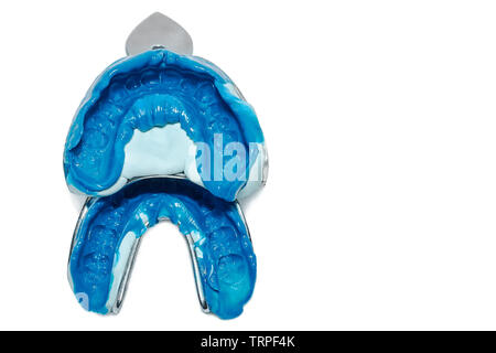 Deux des empreintes dentaires sur fond blanc avec l'exemplaire de l'espace. Moules de dentaire les mâchoires supérieure et inférieure du matériel de silicone. L'empreinte de l'toot Banque D'Images