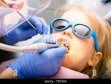 Effectuer la procédure de remplissage dentaire dentiste pour une petite fille à la clinique de dentisterie pédiatrique. Calme enfant est assis dans un fauteuil dentaire portant des lunettes de soleil ho Banque D'Images