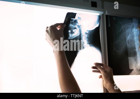 Portrait of woman examining cou x-ray sur l'outil de diagnostic médical Banque D'Images