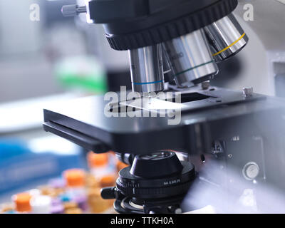 Close-up de la diapositive avec échantillon de sang sur microscope in laboratory Banque D'Images