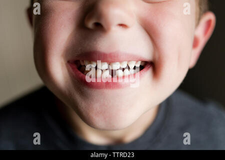 Close-up of boy showing crantée gap Banque D'Images