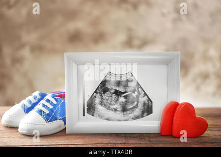 Photo d'échographie de bébé en cadre photo et Chaussures enfants sur la table Banque D'Images