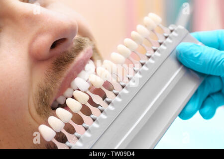 Contrôle et sélection de dentiste de couleur des dents du jeune homme, gros plan Banque D'Images