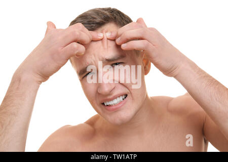 Beau jeune homme avec des problèmes de peau sur fond blanc Banque D'Images