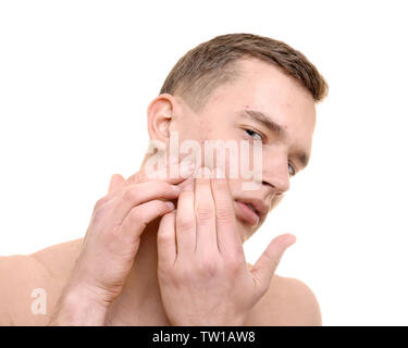 Beau jeune homme avec des problèmes de peau sur fond blanc Banque D'Images