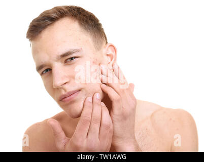 Beau jeune homme avec des problèmes de peau sur fond blanc Banque D'Images