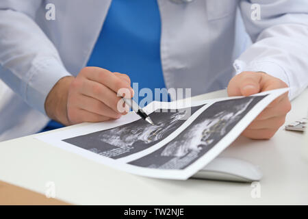 Médecin avec sonogramme de droit et un stylo dans office, gros plan Banque D'Images