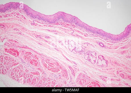 La section longitudinale des droits de l'oesophage, 100 fois magnifiée par microscope optique, H-E taches Banque D'Images