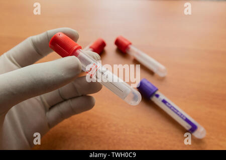 Pro-activateur de coagulation caillot de sang ordinaire du tube de prélèvement avec bouchon en plastique rouge,s'est tenue à la main en laboratoire. Banque D'Images