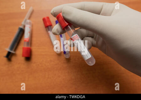 Pro-activateur de coagulation caillot de sang ordinaire du tube de prélèvement avec bouchon en plastique rouge,s'est tenue à la main en Inde, de laboratoire. Banque D'Images