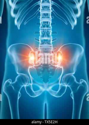 Médicalement en rendu 3d illustration de précises articulations douloureuses sacrum Banque D'Images